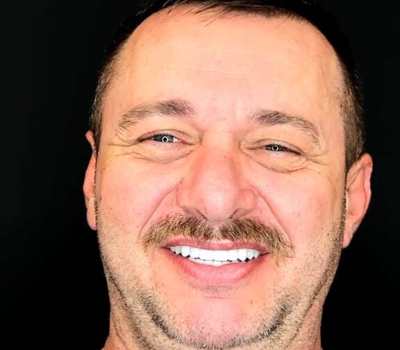 Имплантация зубов <br> в Санкт-Петербурге <br> под ключ
<br>
<span class="text-primary text-primary-gradient">За 2 часа за 119.000₽</span>